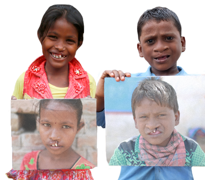 Smile Train virtual reality